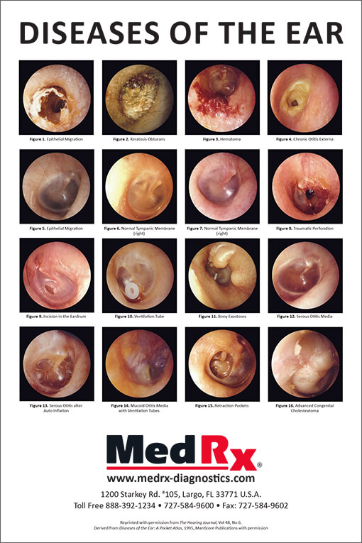MedRx Diseases of the Ear poster